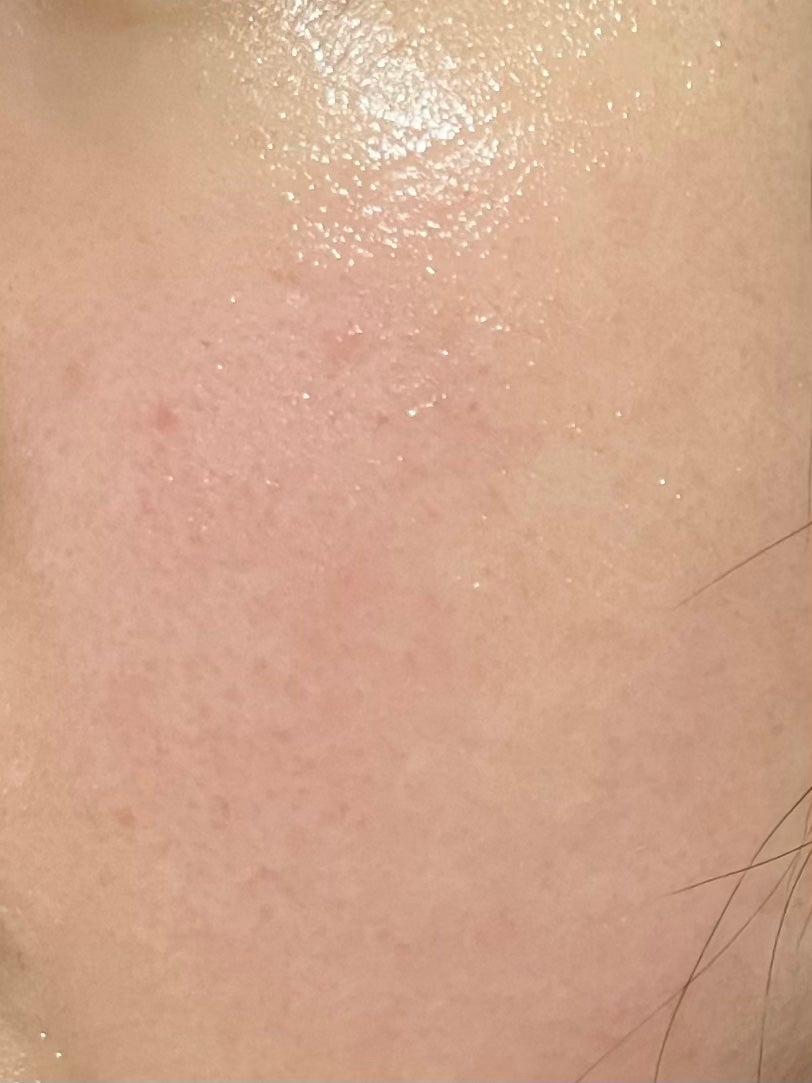 クリアエッセンスマスク/ピュレア/シートマスク・パックを使ったクチコミ(3枚目)