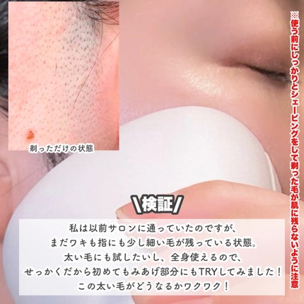 光エステ スムースエピ ES-WG0A/Panasonic/家庭用脱毛器を使ったクチコミ(6枚目)