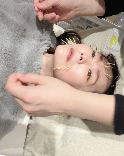 しのち☀️ on LIPS 「顔が凝って目も開かないよお〜アンパンマンばりに首から上がどーに..」(4枚目)