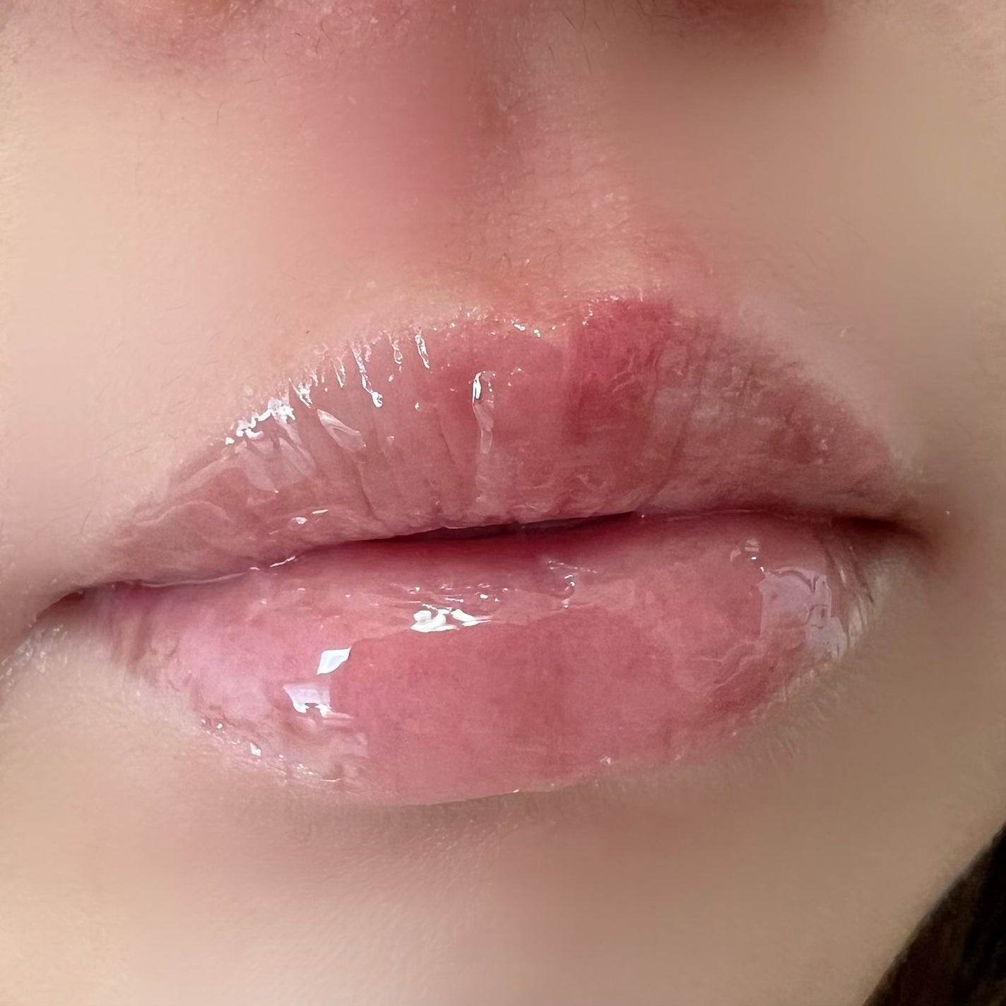 PDRNショット リッププランパー/fractionalCC/リッププランパーを使ったクチコミ(3枚目)