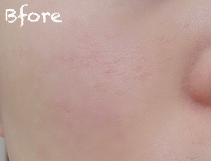 グリーントマトクレイマスククレンザー/FULLY/洗い流すパック・マスクを使ったクチコミ(4枚目)