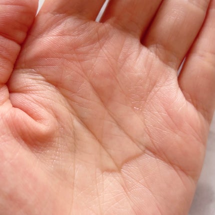 メディショット ダーマ&ボタニカル  リンクル美容液ローション/MEDI SHOT/化粧水を使ったクチコミ(4枚目)