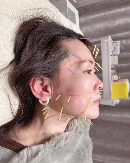 しのち☀️ on LIPS 「顔が凝って目も開かないよお〜アンパンマンばりに首から上がどーに..」(5枚目)