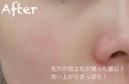 グリーントマトクレイマスククレンザー/FULLY/洗い流すパック・マスクを使ったクチコミ(5枚目)