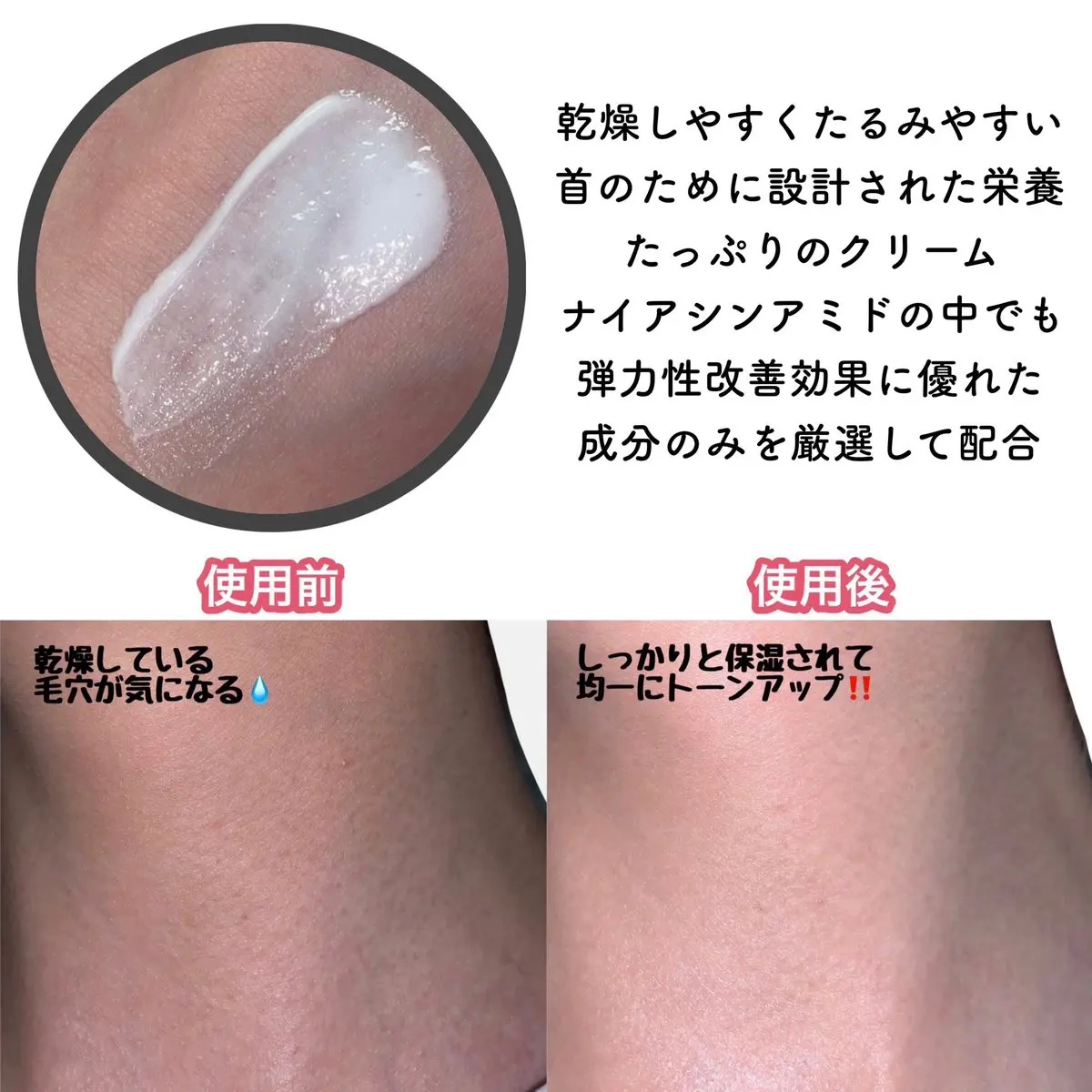 BnD ネックアイロン トーンアップ クリーム/BnD/ネック・デコルテケアを使ったクチコミ（2枚目）