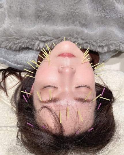 しのち☀️ on LIPS 「顔が凝って目も開かないよお〜アンパンマンばりに首から上がどーに..」(7枚目)