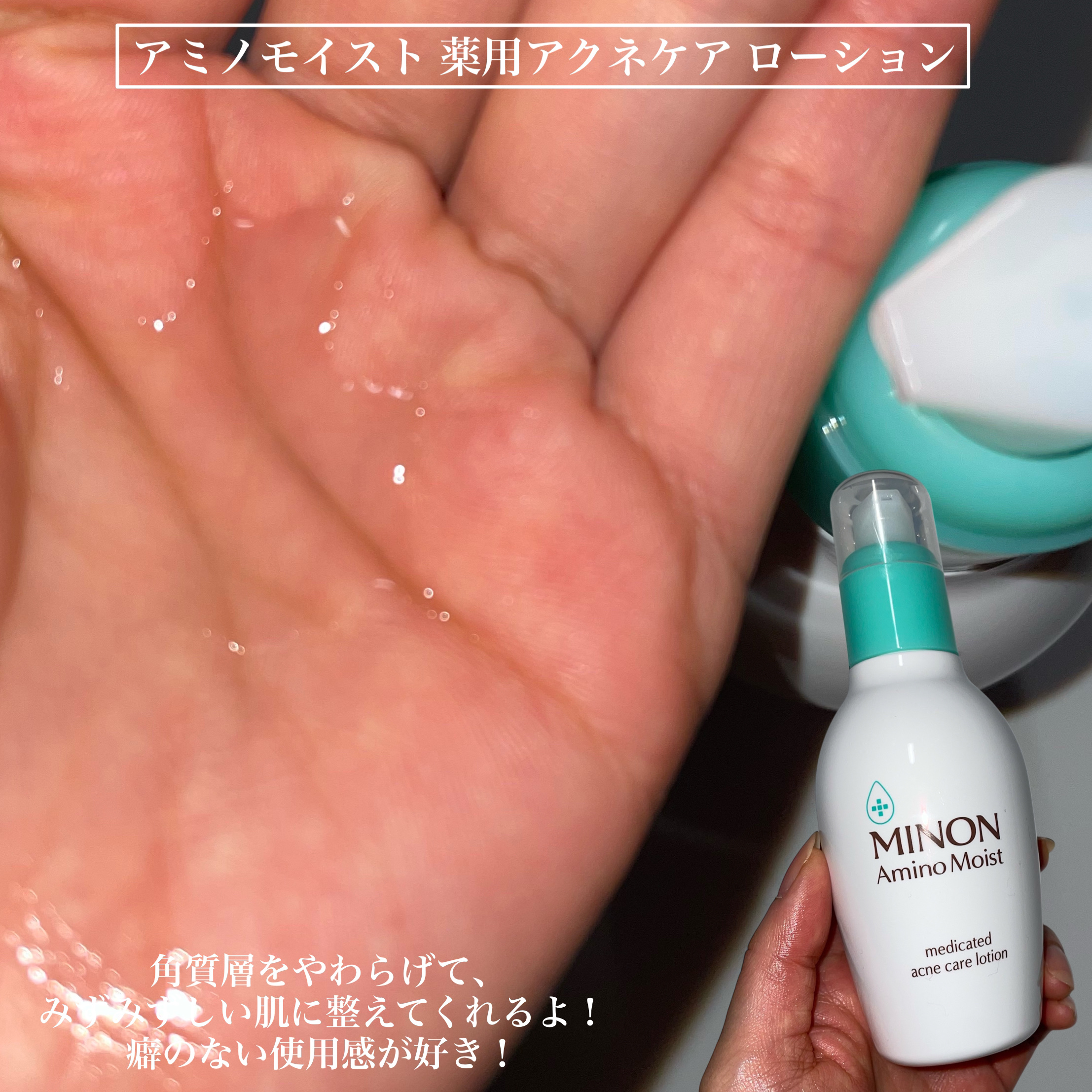 ミノン アミノモイスト 薬用アクネケア ローション/ミノン/化粧水を使ったクチコミ（3枚目）