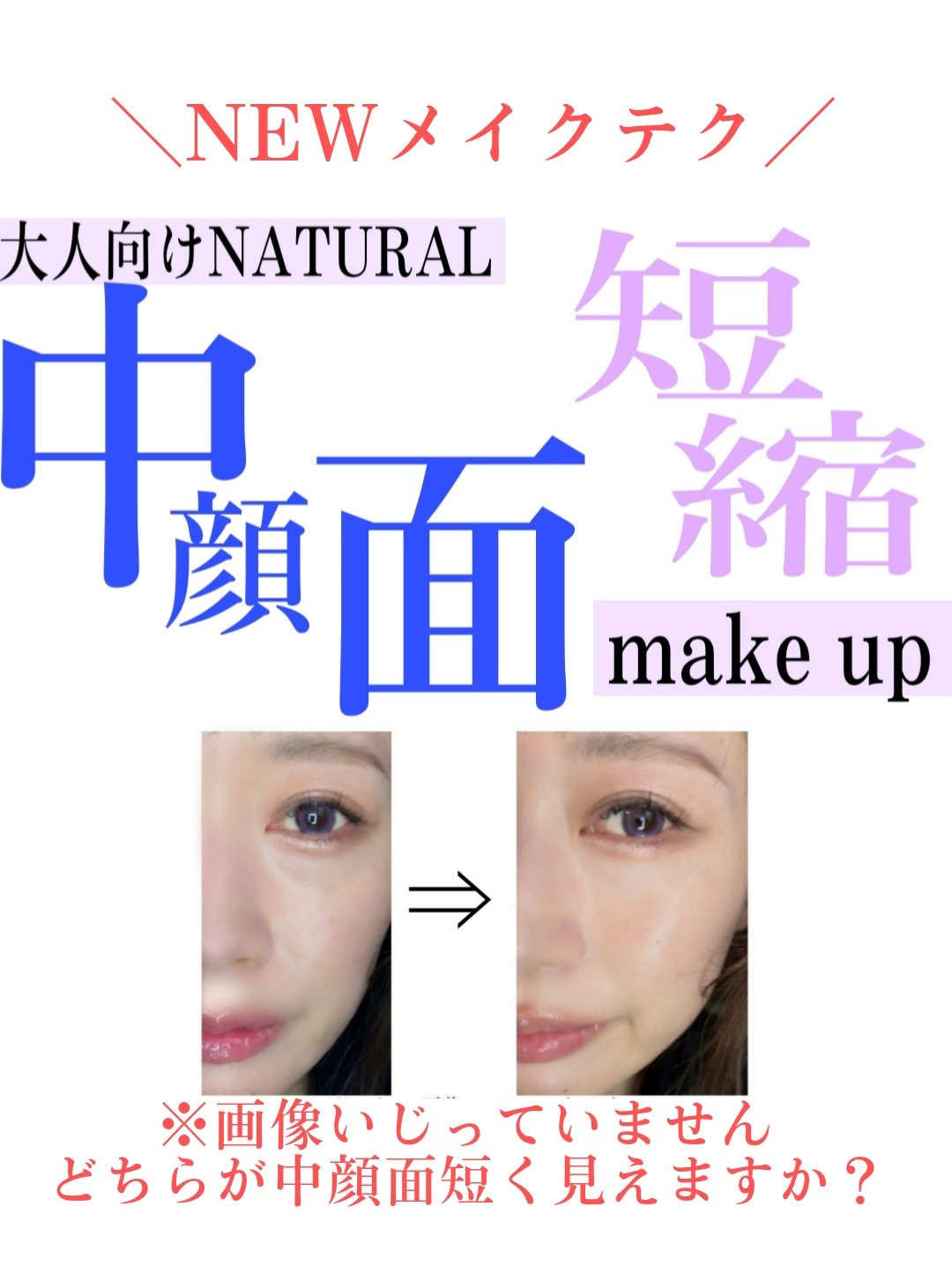 カバーパーフェクション トリプル ポット コンシーラー 05 ダークアップベージュ/the SAEM/パレットコンシーラーを使ったクチコミ（1枚目）