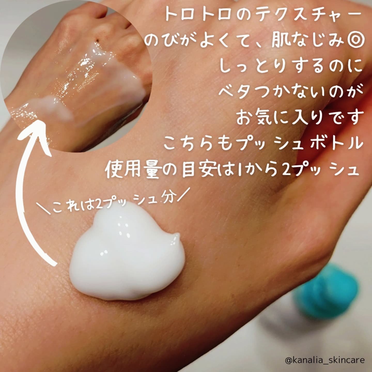 ミノン アミノモイスト 薬用アクネケア ローション/ミノン/化粧水を使ったクチコミ（3枚目）