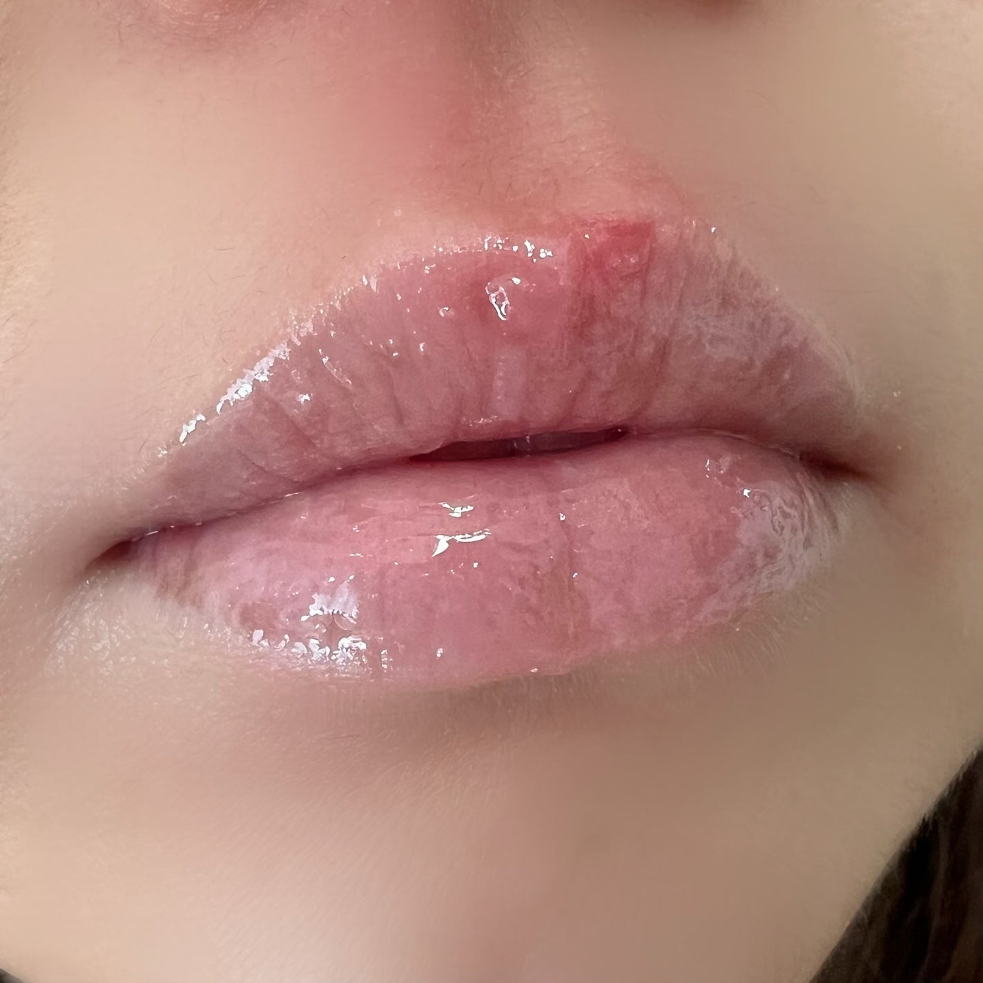 PDRNショット リッププランパー/fractionalCC/リッププランパーを使ったクチコミ(2枚目)