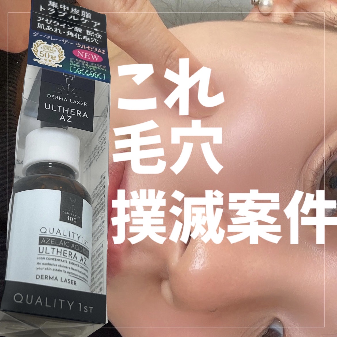 ダーマレーザー ウルセラAZ/クオリティファースト/美容液を使ったクチコミ（1枚目）