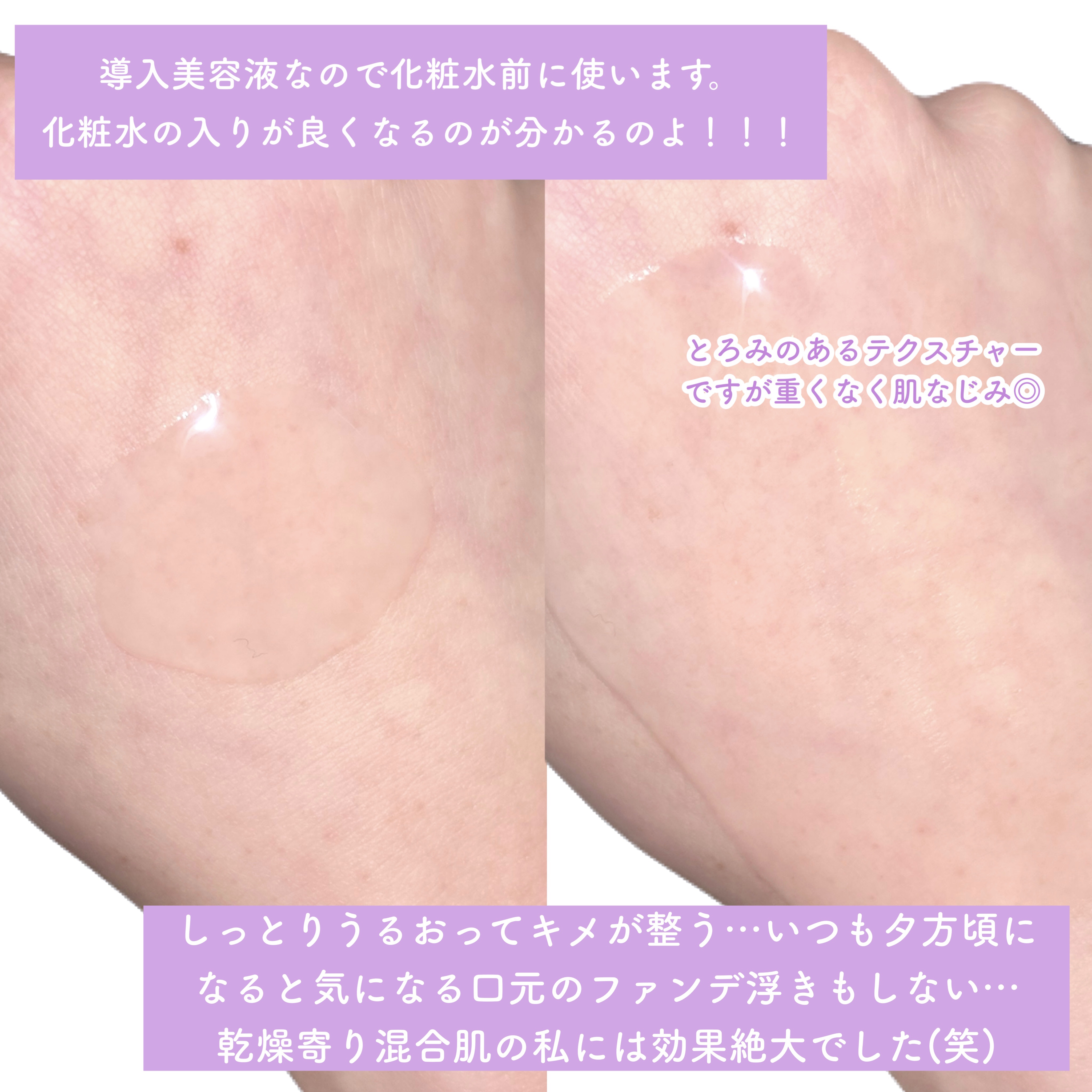 セラムヴェール ディープリペア/ONE BY KOSE/美容液を使ったクチコミ（3枚目）