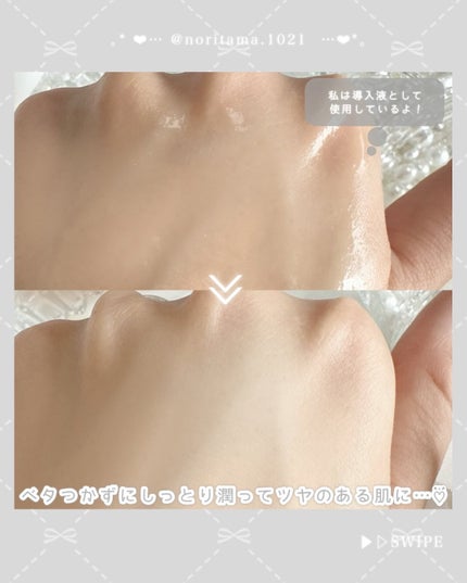 ガラク ナイアシン 3.0 エッセンス/manyo/美容液を使ったクチコミ(4枚目)