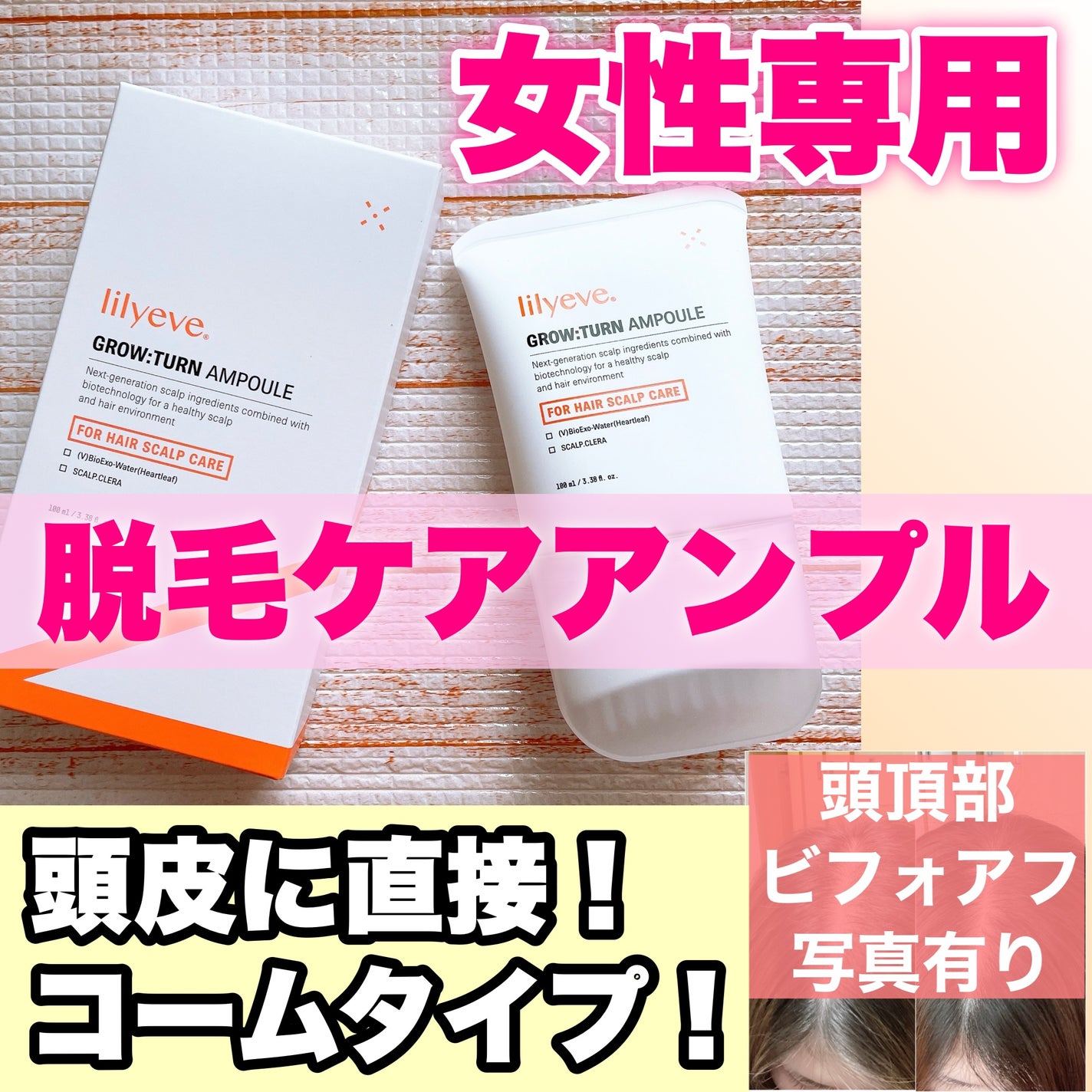 グローターン 100ml/リリーイブ/頭皮ローションを使ったクチコミ(1枚目)