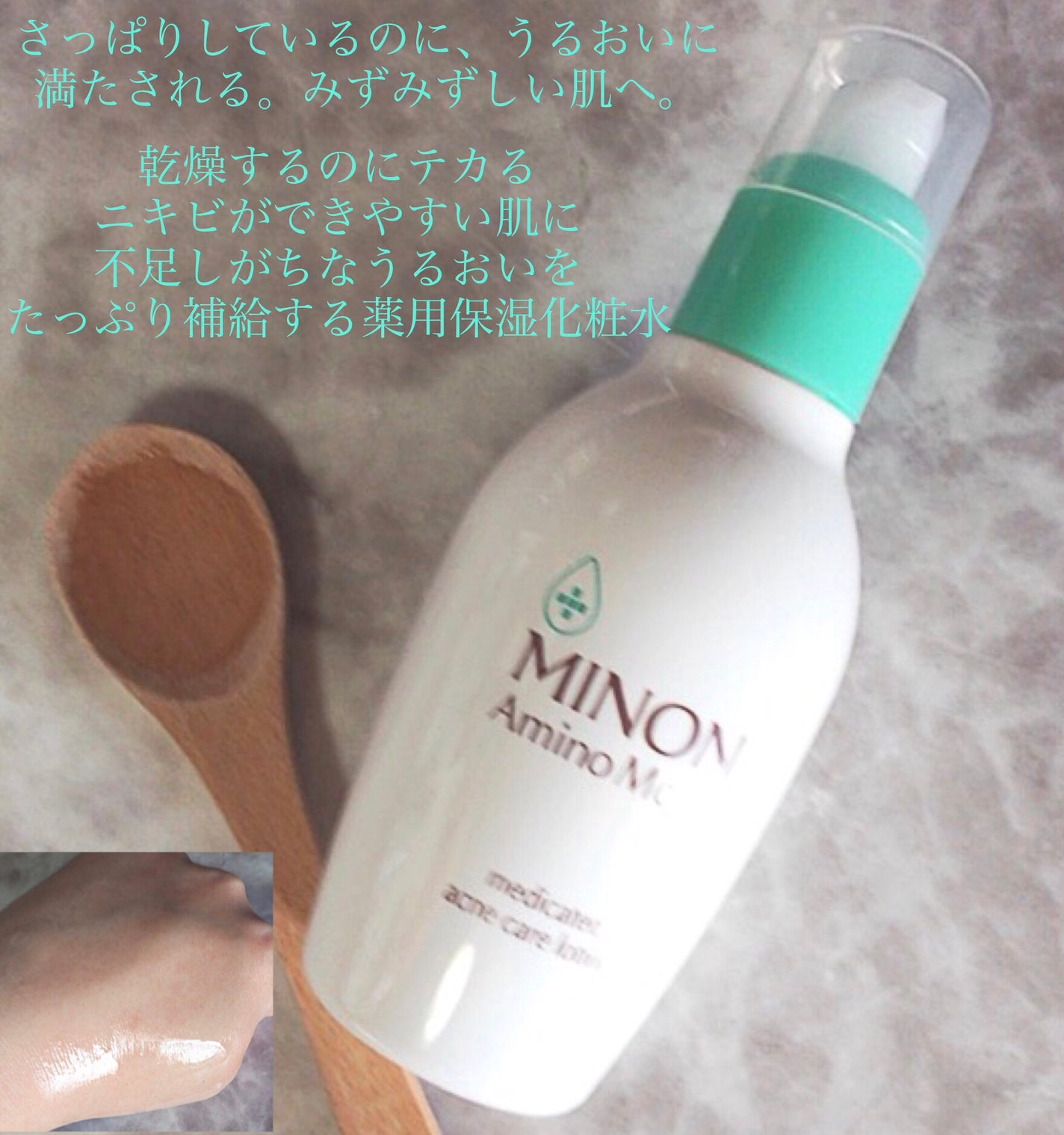 ミノン アミノモイスト 薬用アクネケア ローション/ミノン/化粧水を使ったクチコミ(2枚目)