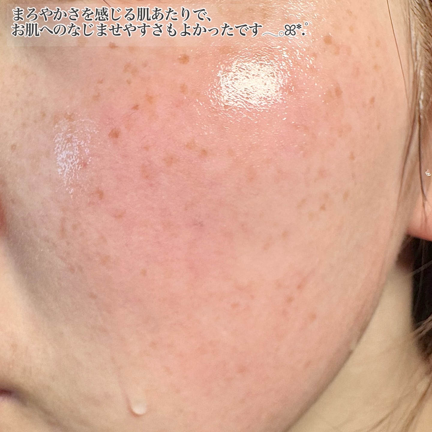 TXナイアシンエッセンストナー/SKIN&LAB/化粧水を使ったクチコミ（3枚目）