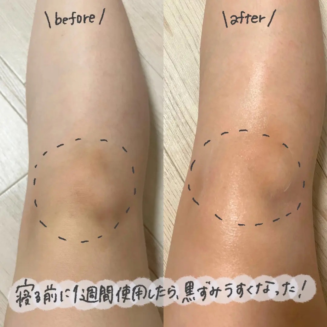 BnDアンダーアームクリーム(ボディクリーム)/BnD/デリケートゾーンケアを使ったクチコミ（3枚目）