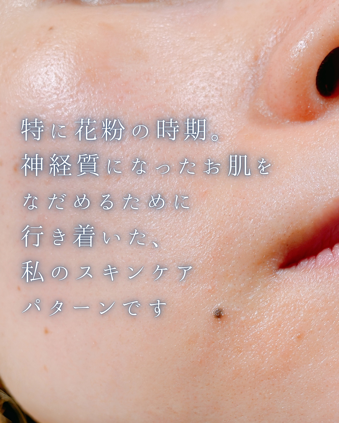 ローション/キュレル/ボディローションを使ったクチコミ（2枚目）