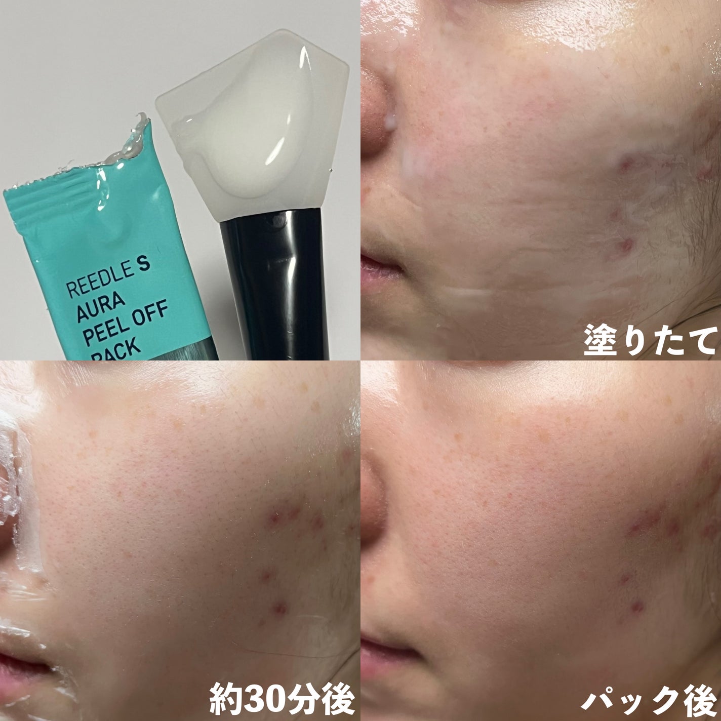 リードルS ピールオフパック/VT/シートマスク・パックを使ったクチコミ(5枚目)