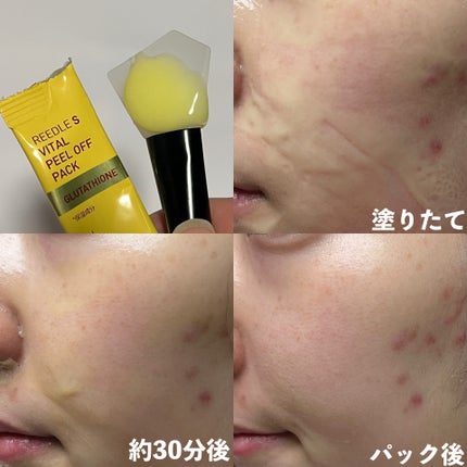 リードルS ピールオフパック/VT/シートマスク・パックを使ったクチコミ(4枚目)