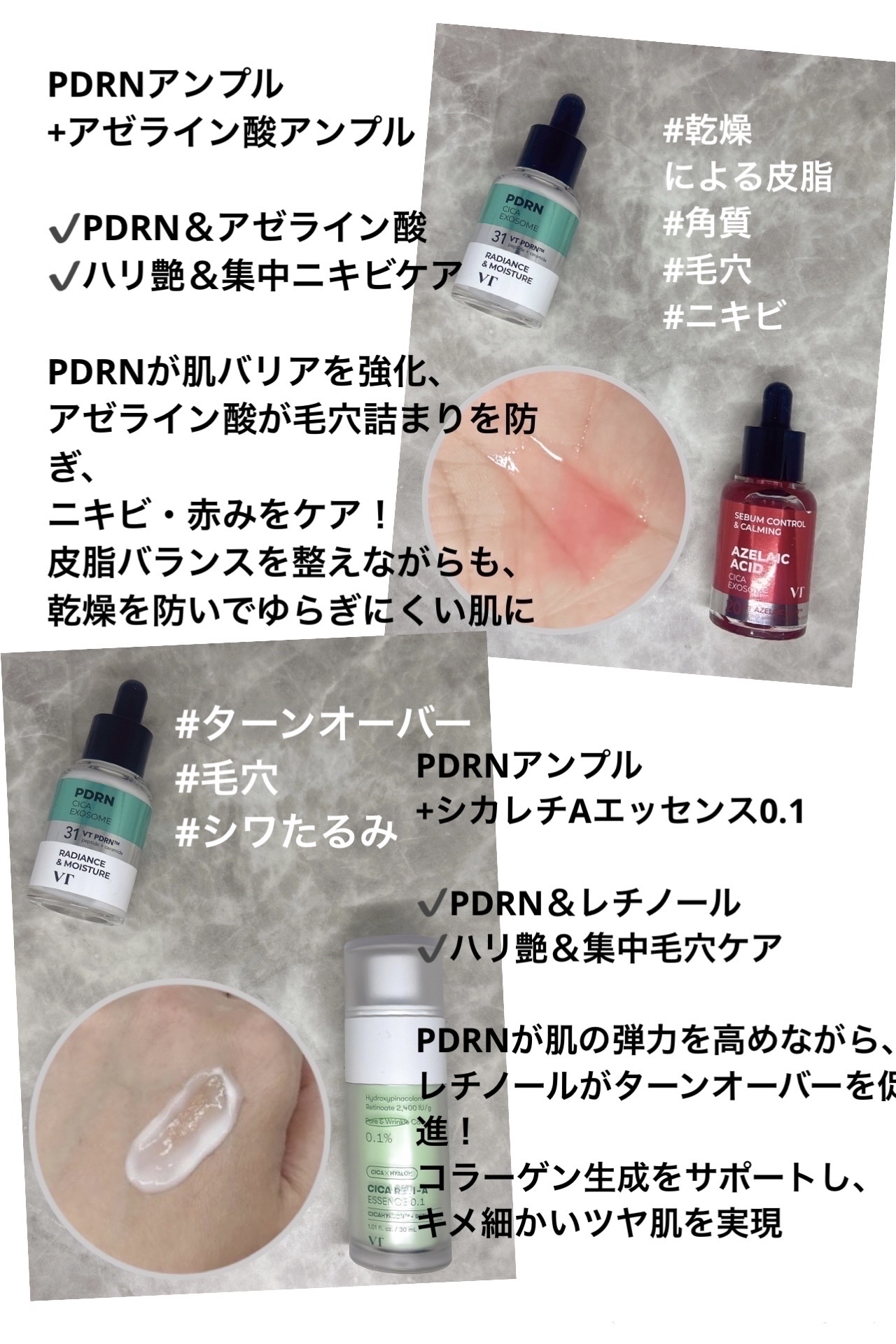 シカレチA エッセンス0.1/VT/美容液を使ったクチコミ（3枚目）