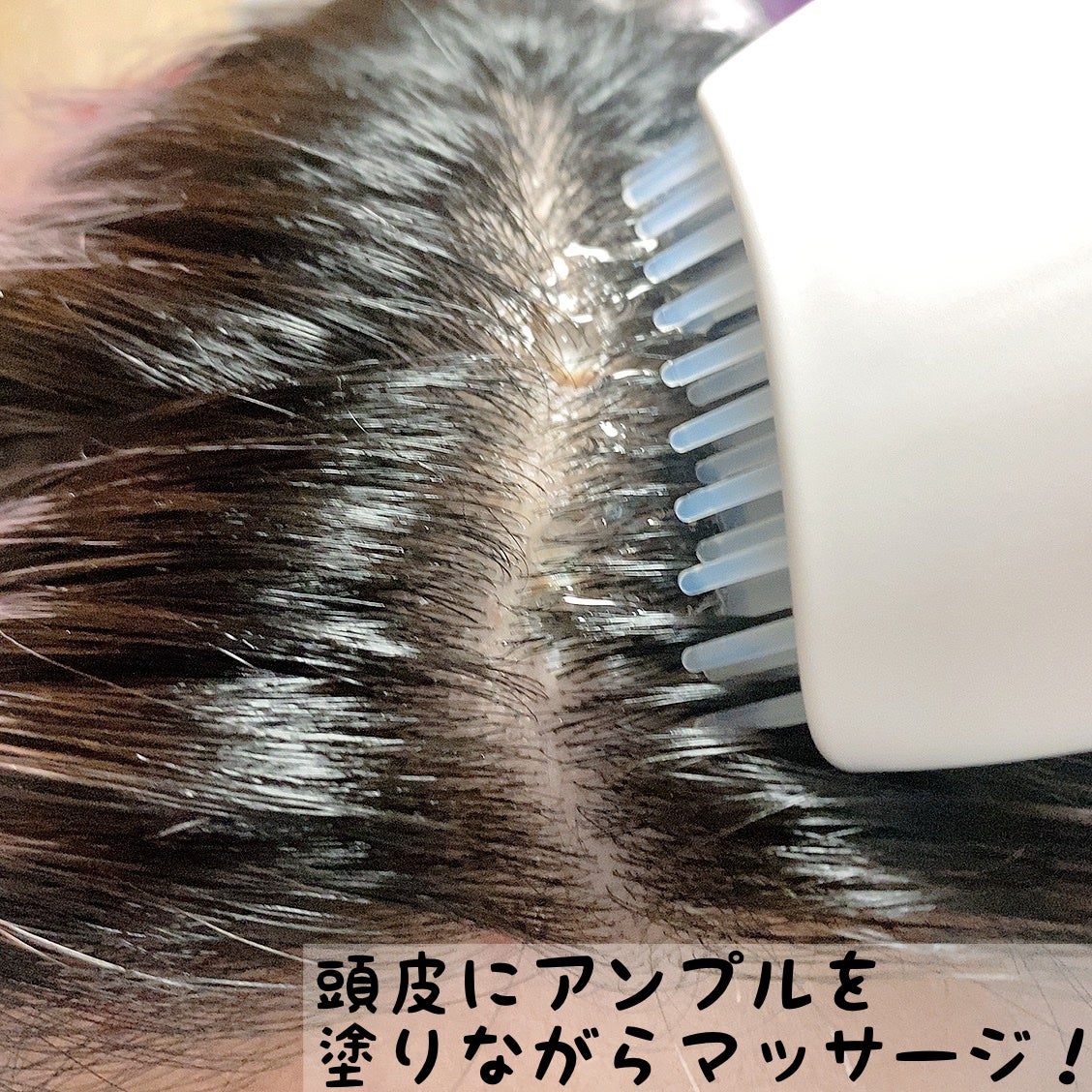 グローターン 100ml/リリーイブ/頭皮ローションを使ったクチコミ(3枚目)