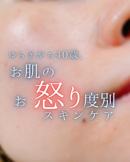 ローション/キュレル/ボディローションを使ったクチコミ(1枚目)