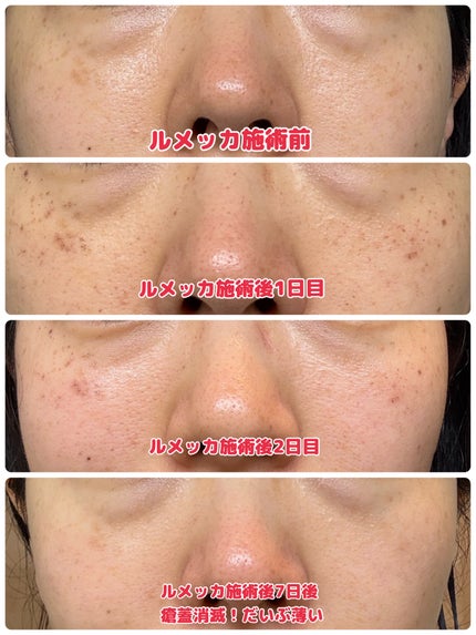 を使ったクチコミ(2枚目)