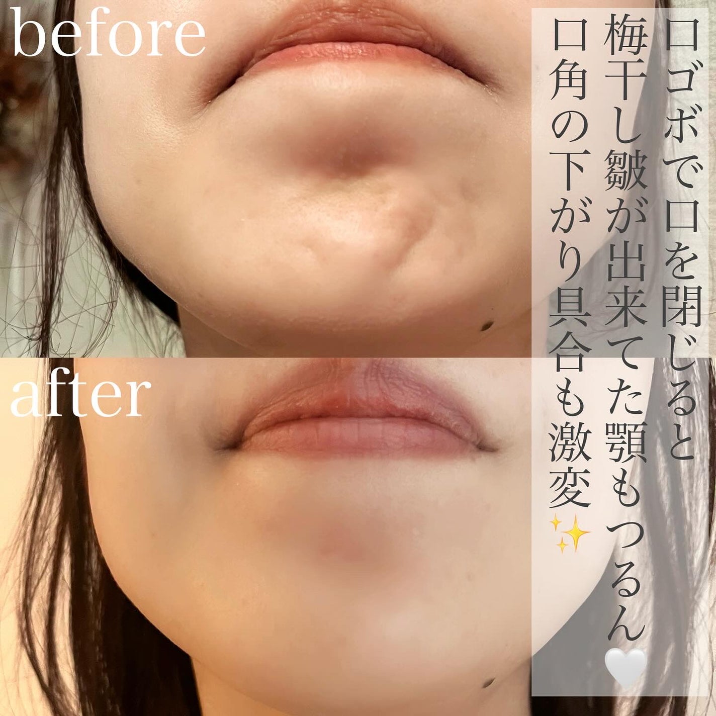 manað«§ãããã©ã§æ¥œãã倧人ã®çŸå®¹/ã³ã¹ã¡ on LIPS ããããã®ãããã¯ã¹åäœæ°//é¡10çé15ã¬ããŒã¹ãã€ã«10é¡..ãïŒ4æç®ïŒ