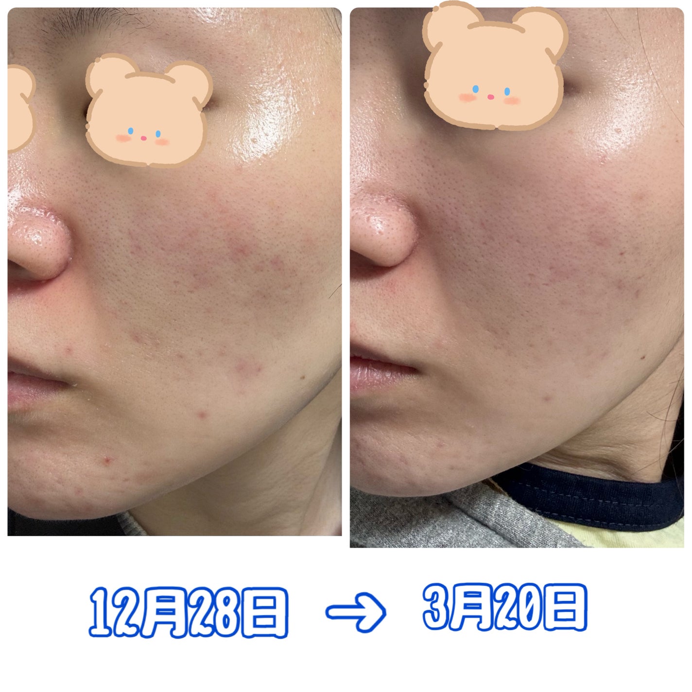 ルミナスHQブースター/アンプルール/ブースター・導入液を使ったクチコミ(3枚目)