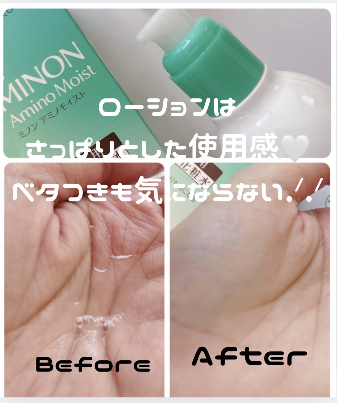 ミノン アミノモイスト 薬用アクネケア ローション/ミノン/化粧水を使ったクチコミ（2枚目）