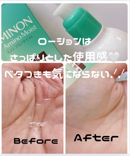 ミノン アミノモイスト 薬用アクネケア ミルク/ミノン/乳液を使ったクチコミ(2枚目)