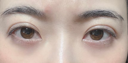 ジュメル アイクリーム/Jumel(ジュメル)/アイケア・アイクリームを使ったクチコミ(1枚目)