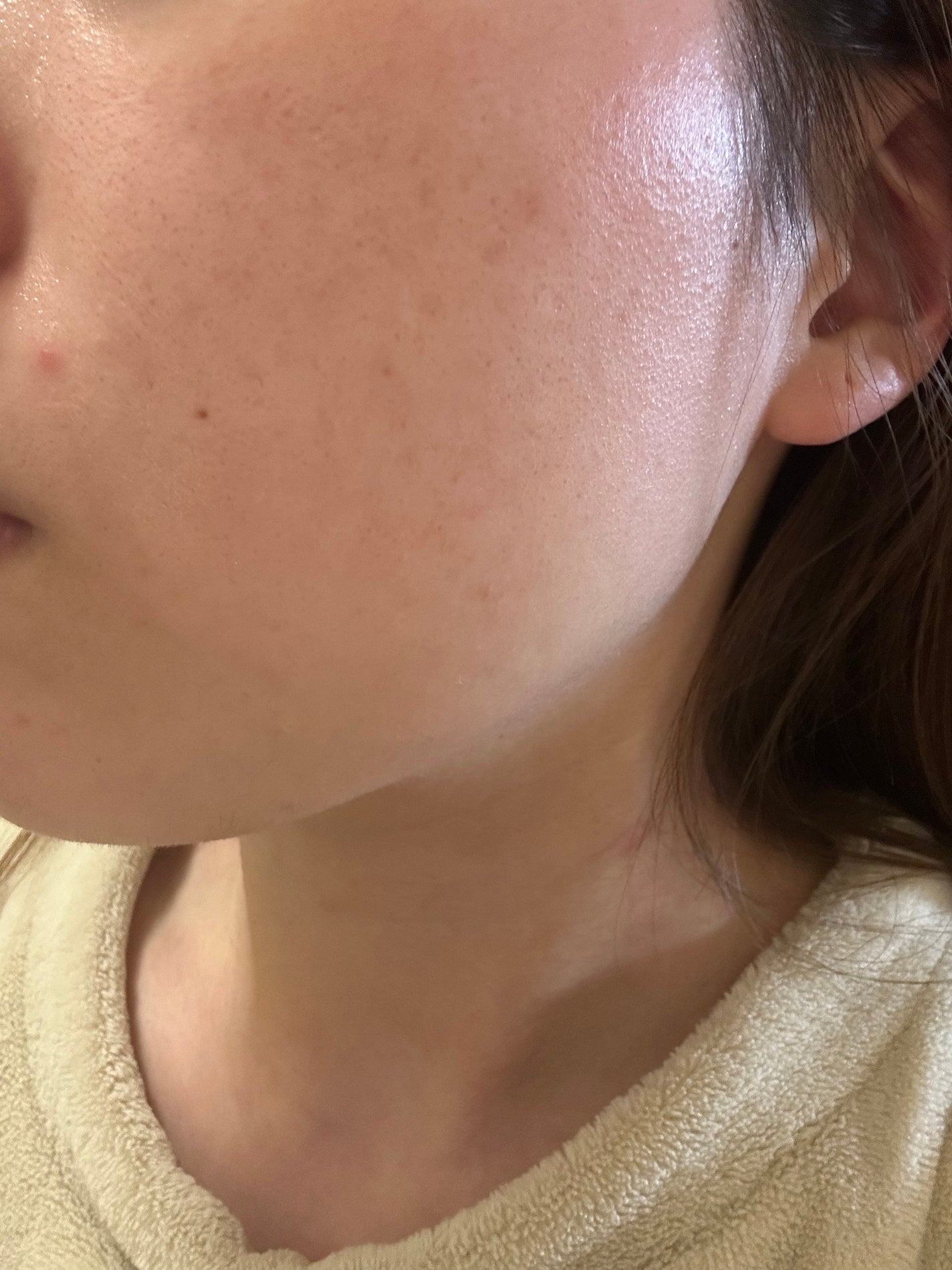 レチノール シカ リペア セラム/innisfree/美容液を使ったクチコミ(4枚目)