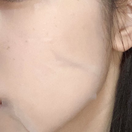 レッドブレミッシュクイックPHAシートマスク/Dr.G/シートマスク・パックを使ったクチコミ(4枚目)