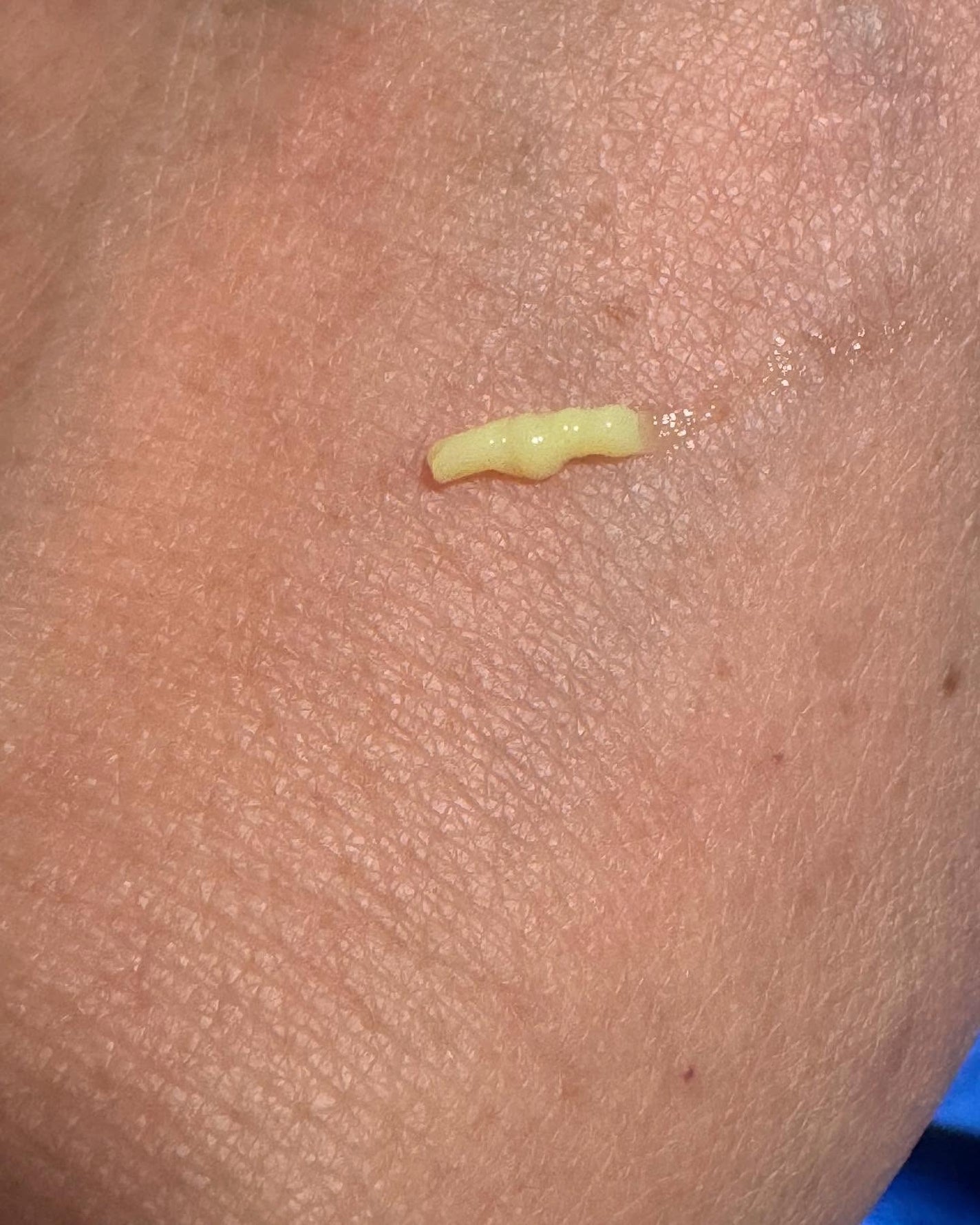 VITALIFT A forte/Dr.Different/フェイスクリームを使ったクチコミ(5枚目)