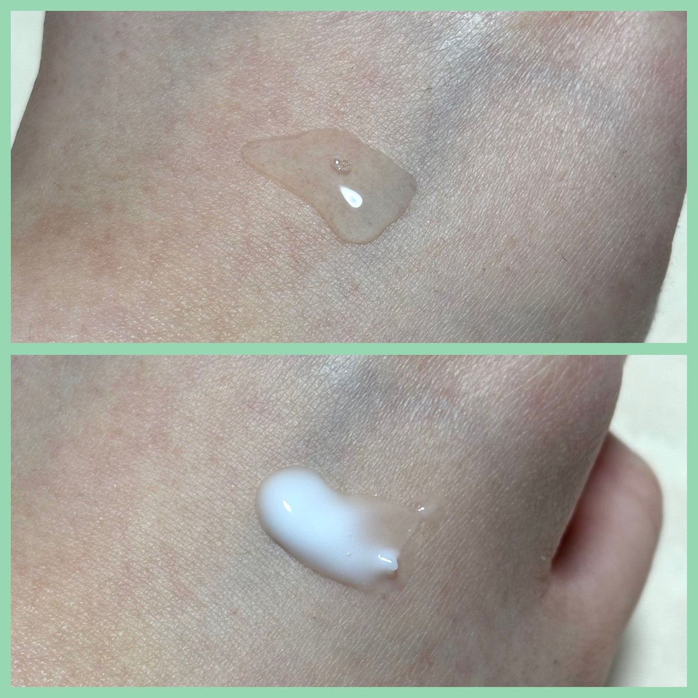 ããã³ ã¢ããã¢ã€ã¹ã è¬çšã¢ã¯ãã±ã¢ ããŒã·ã§ã³/ããã³/åç²§æ°Žã䜿ã£ãã¯ãã³ãïŒ2æç®ïŒ