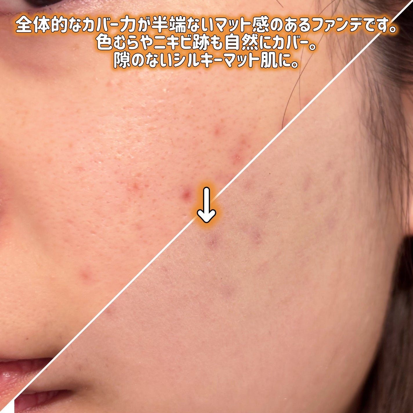 カバーパーフェクションコンシーラークッション/the SAEM/リキッドコンシーラーを使ったクチコミ(4枚目)