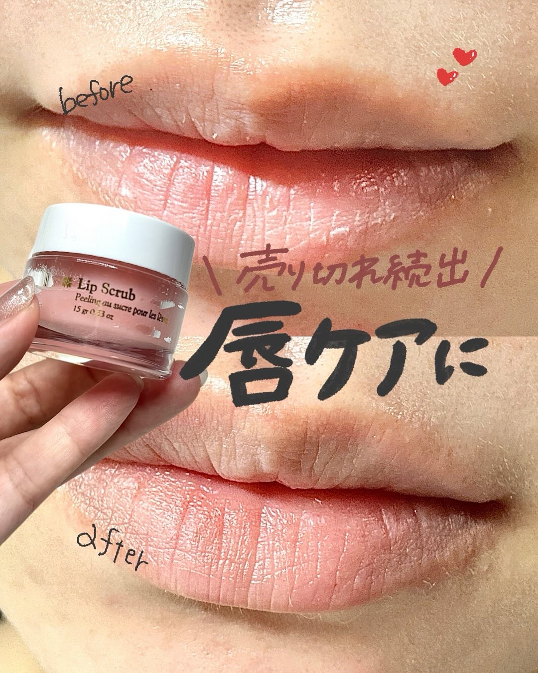 シュガーリップスクラブ /Laline/リップスクラブを使ったクチコミ（1枚目）