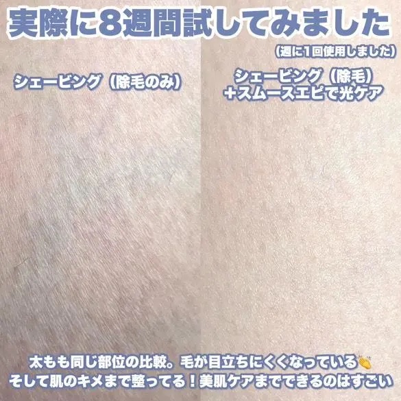 光エステ スムースエピ ES-WG0A/Panasonic/家庭用脱毛器を使ったクチコミ（3枚目）