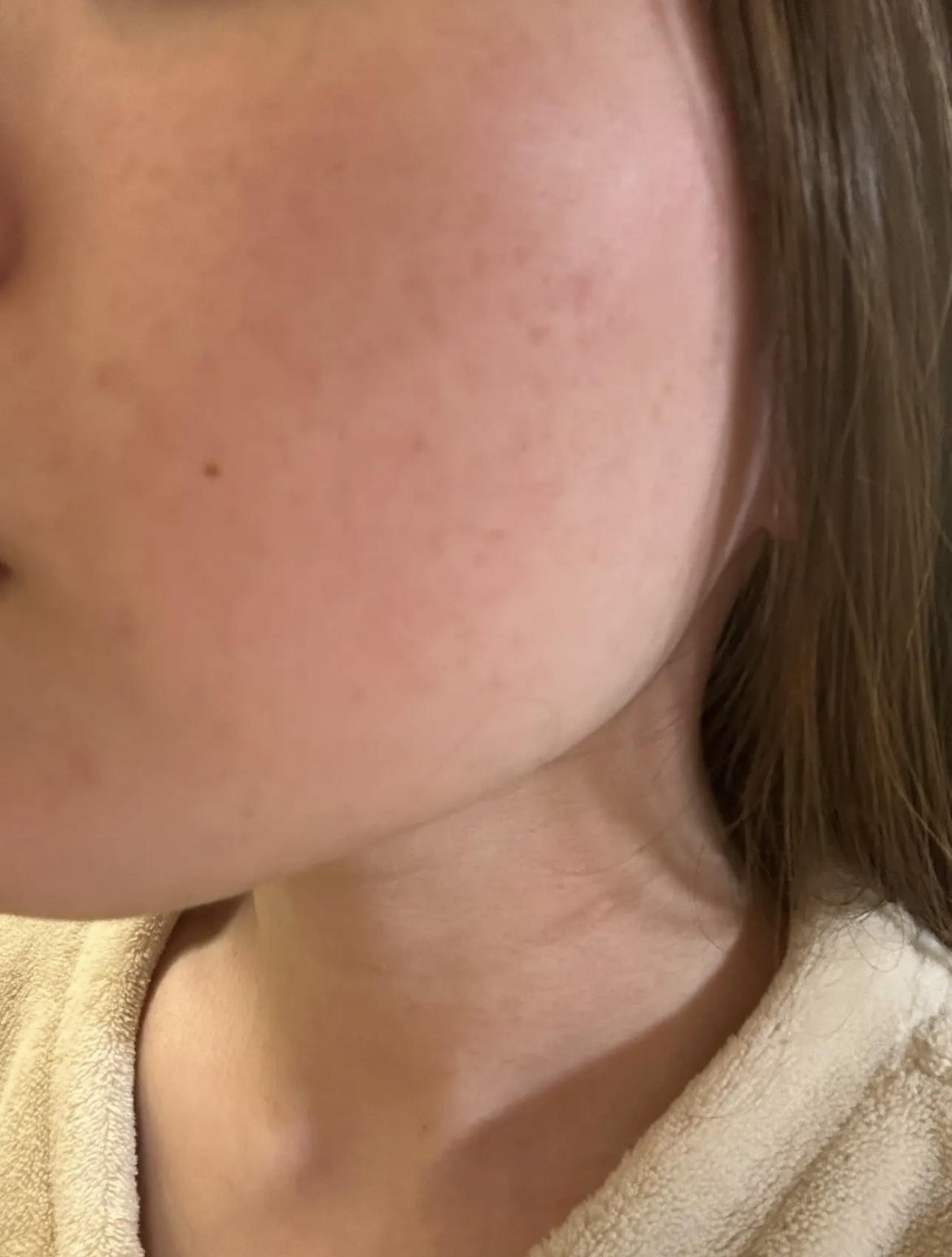 泡洗顔 ディープクリア 180g【旧】/ビフェスタ/泡洗顔を使ったクチコミ（3枚目）