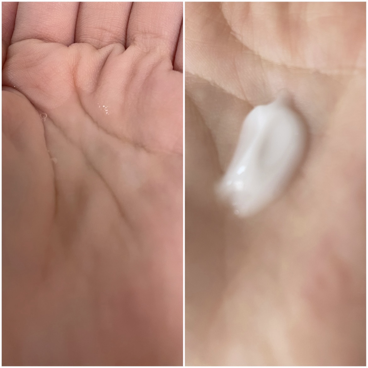 ミノン アミノモイスト 薬用アクネケア ローション/ミノン/化粧水を使ったクチコミ（3枚目）