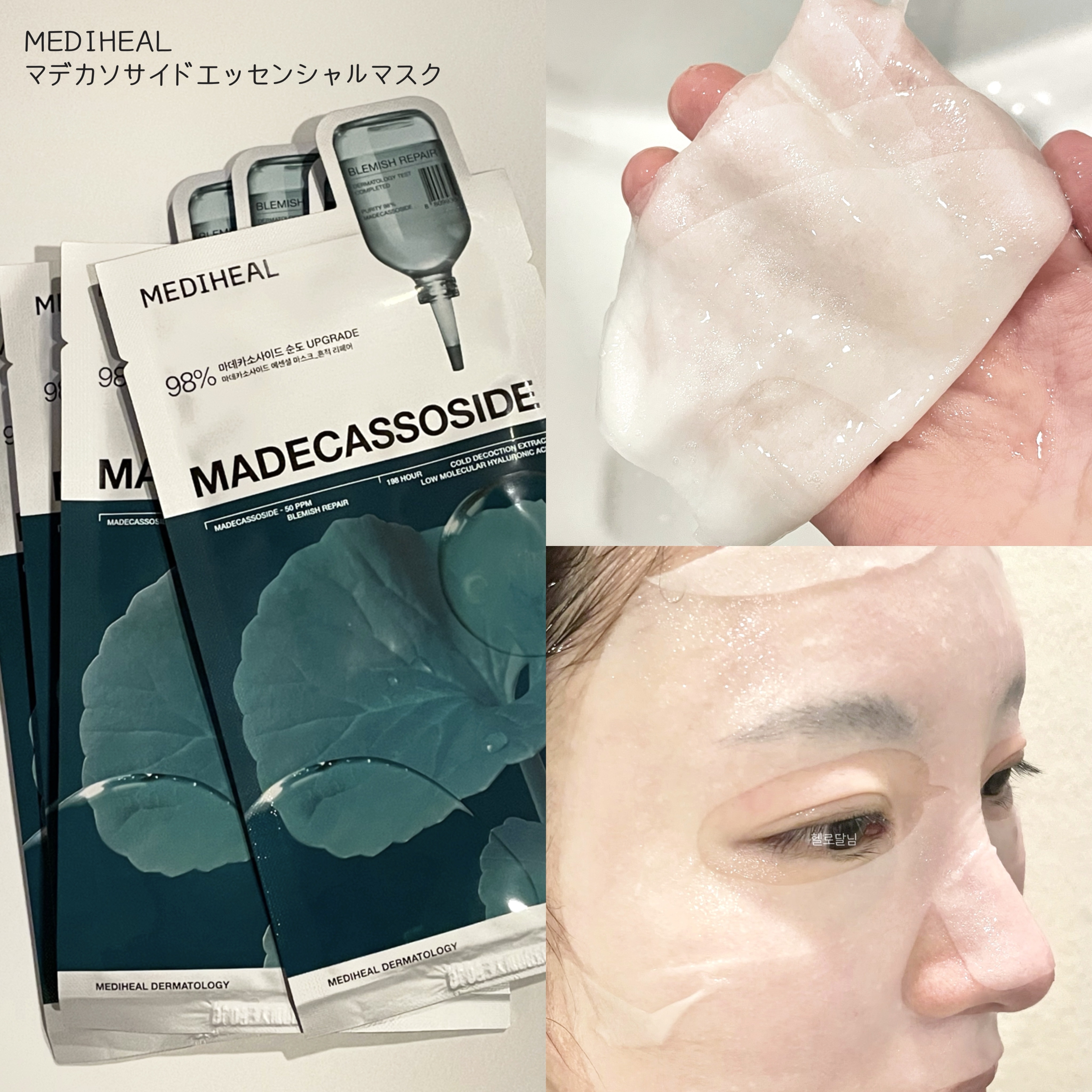 マデカソサイドエッセンシャルマスク/MEDIHEAL/シートマスク・パックを使ったクチコミ（1枚目）