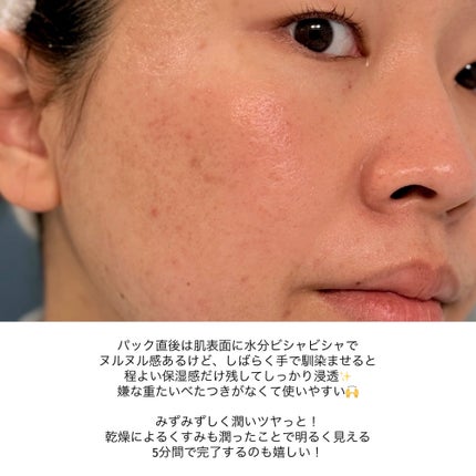 VCãã£ãŒãž ã¹ã ãŒã¹ãã¹ã¯/PERFECT ONE FOCUS/ã·ãŒããã¹ã¯ã»ããã¯ã䜿ã£ãã¯ãã³ãïŒ7æç®ïŒ