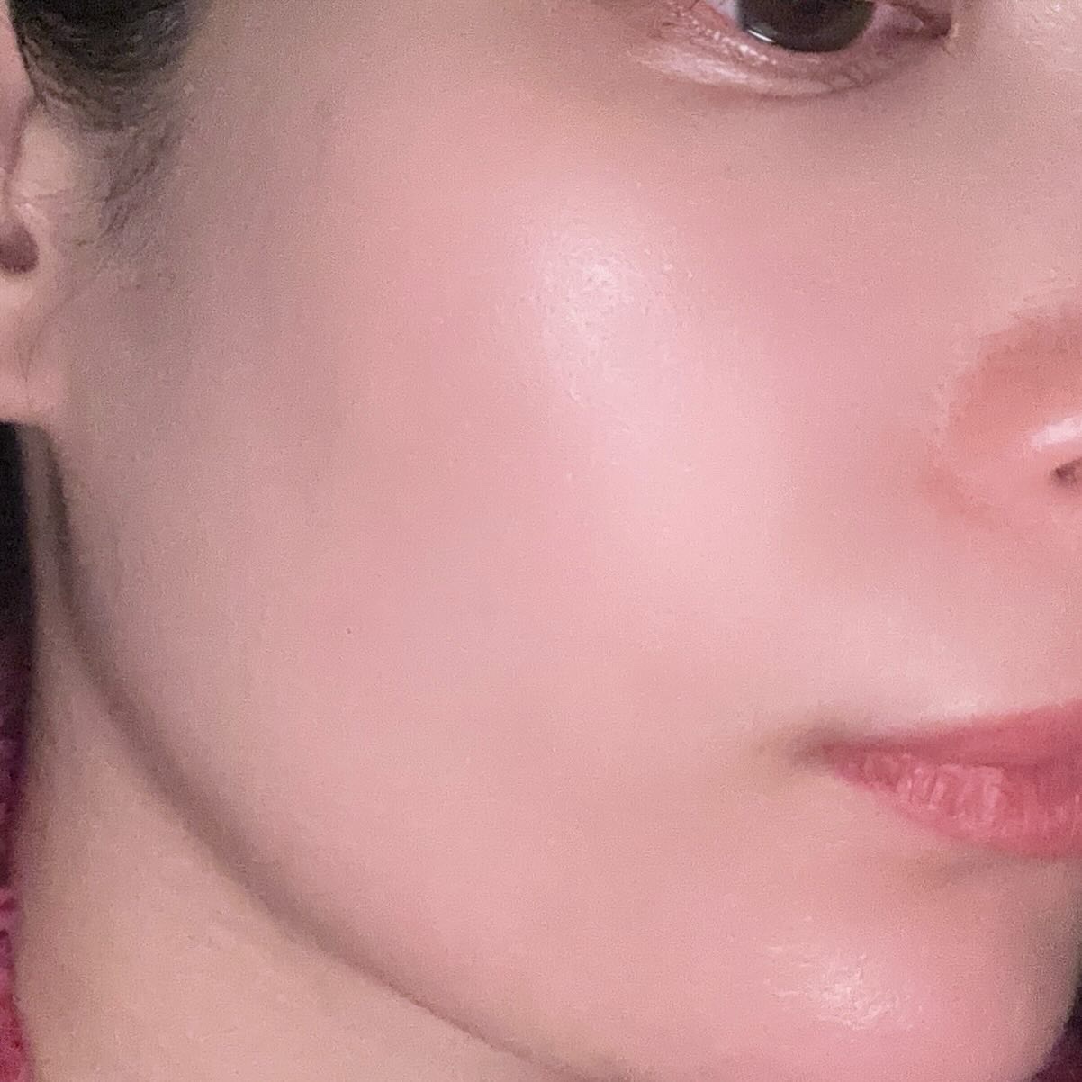 Cemenrete Calcium Intense Ampoule/Dr.Melaxin/美容液を使ったクチコミ（3枚目）