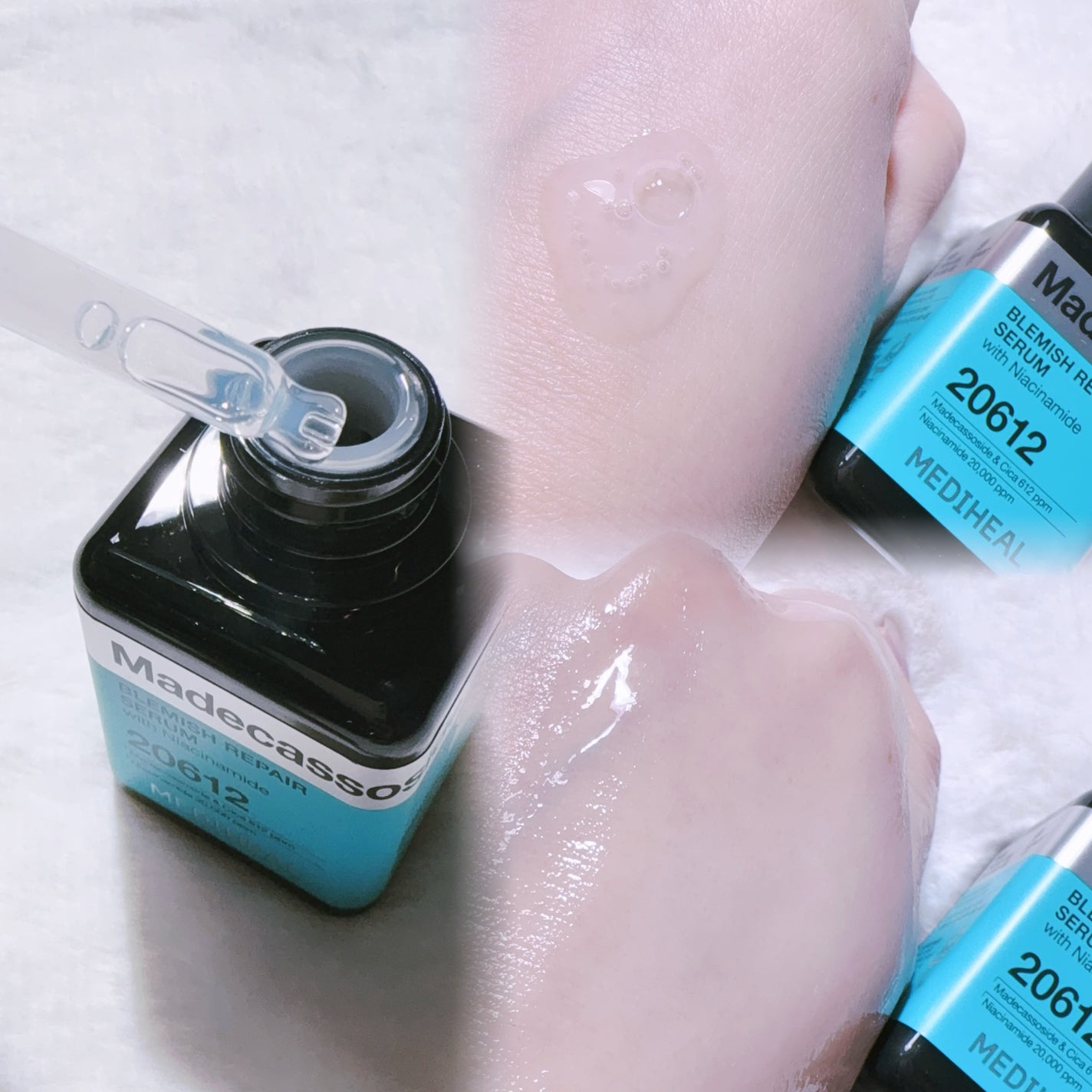 マデカソサイド ブレミッシュパッド/MEDIHEAL/トナーパッドを使ったクチコミ(3枚目)