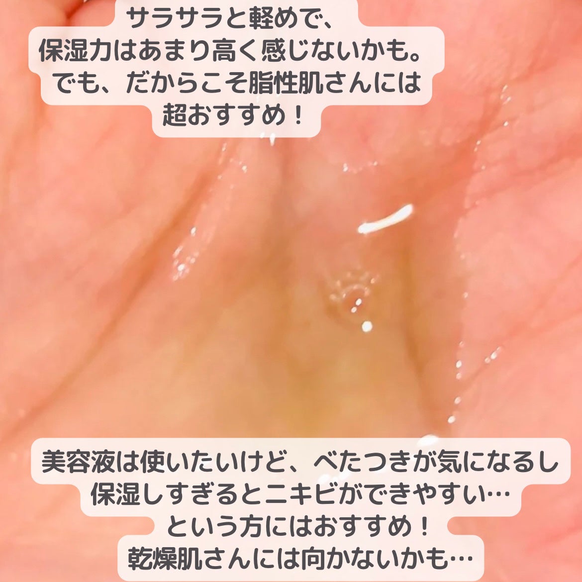 アゼライン酸15 インテンスカーミングセラム/Anua/美容液を使ったクチコミ(2枚目)