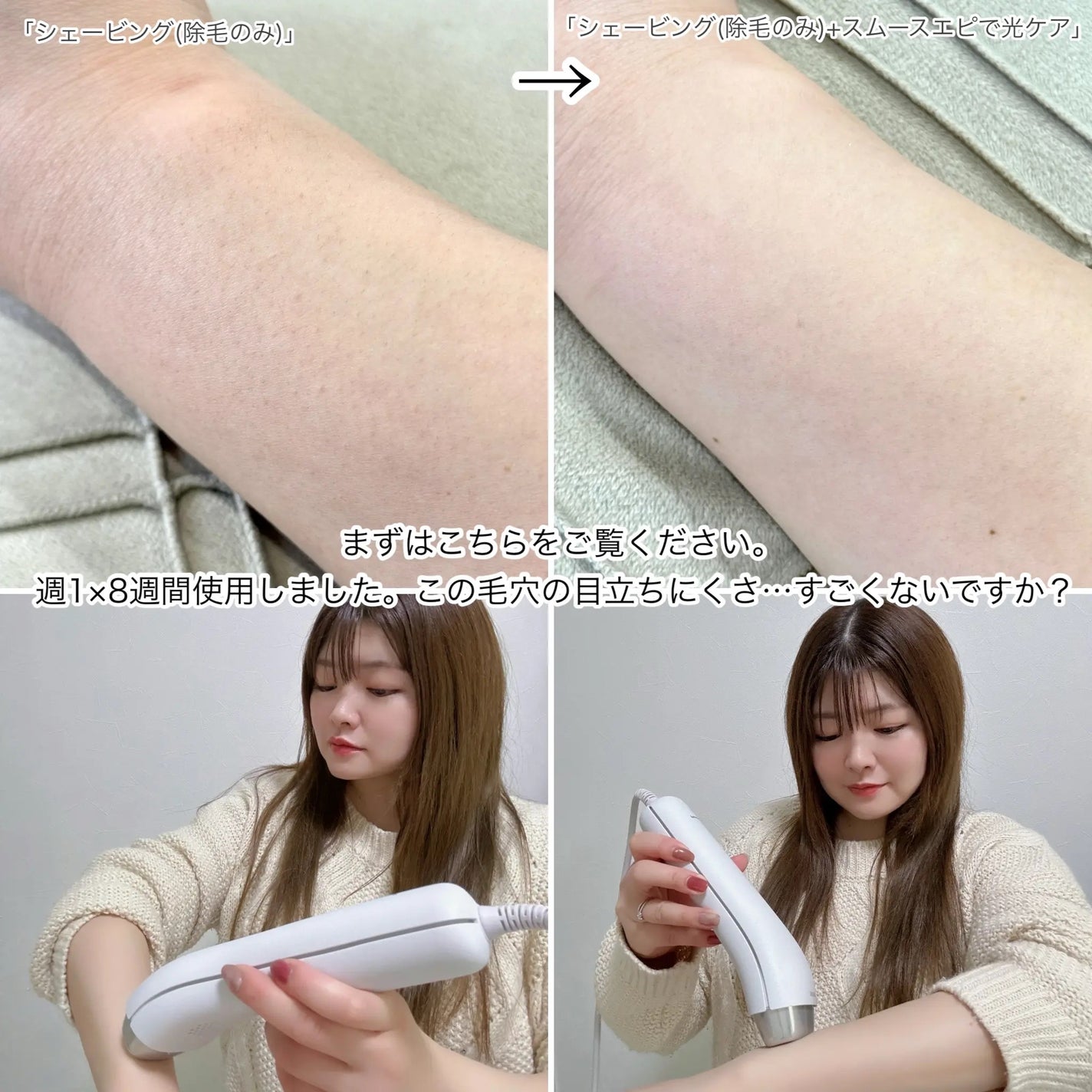 光エステ スムースエピ ES-WG0A/Panasonic/家庭用脱毛器を使ったクチコミ(2枚目)