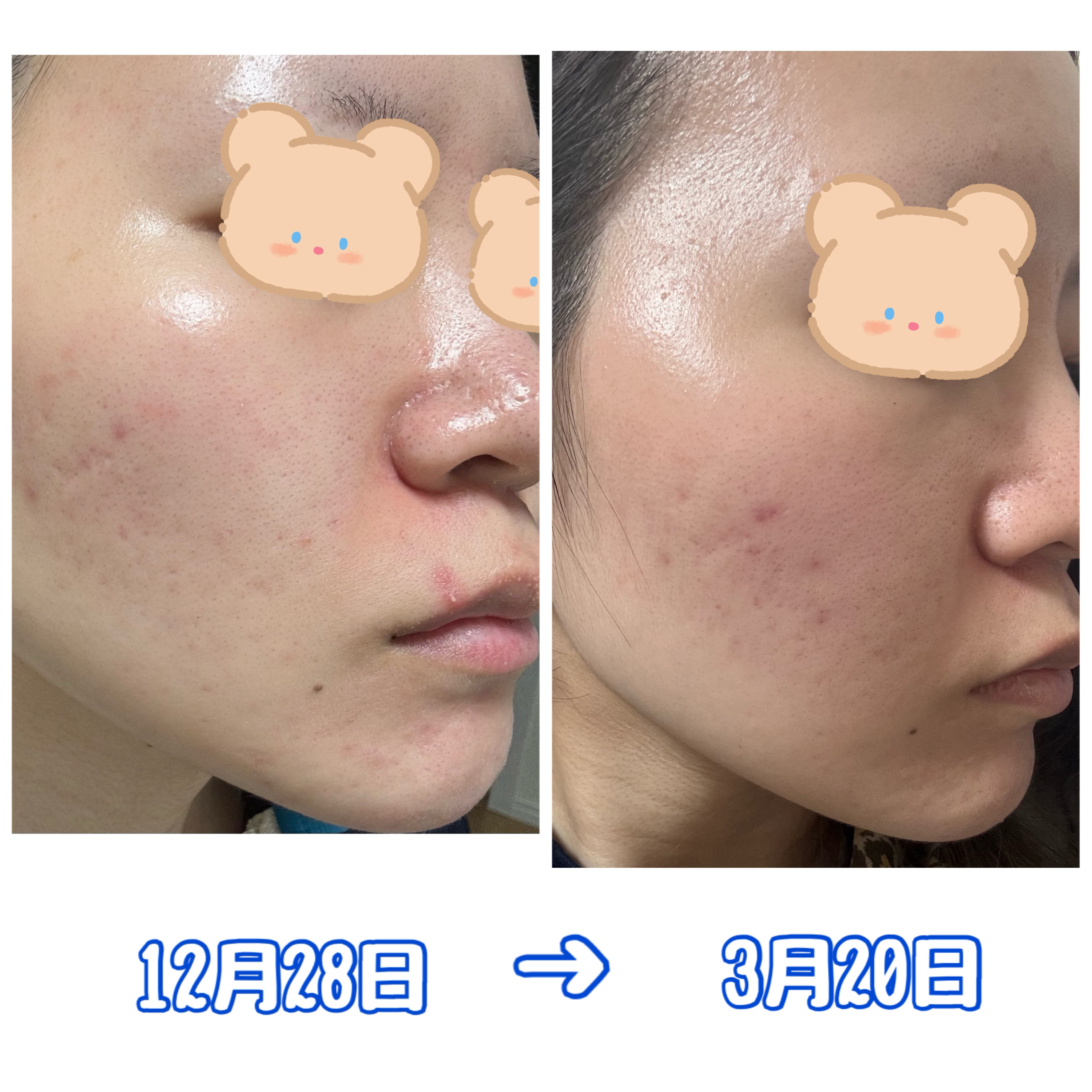 ルミナスHQブースター/アンプルール/ブースター・導入液を使ったクチコミ（2枚目）