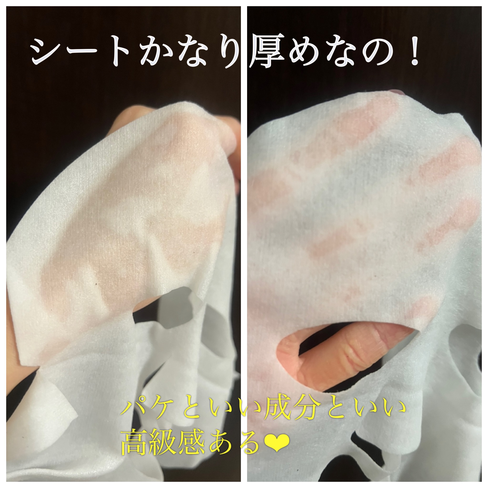 ダーマレーザースペクター VCMAX マスク/クオリティファースト/シートマスク・パックを使ったクチコミ（3枚目）